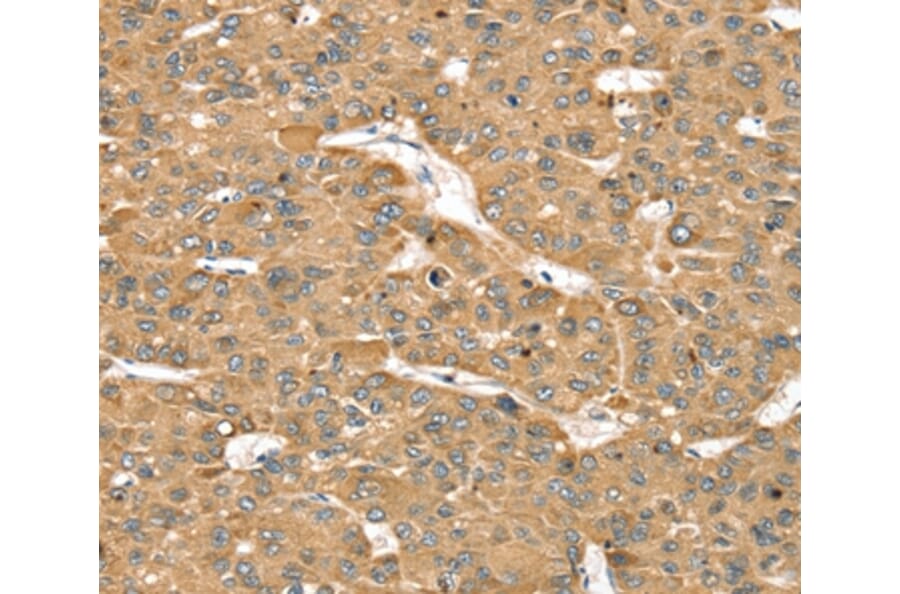 Immunohistochemistry - SMC4 Antibody from Signalway Antibody (37957) - Antibodies.com