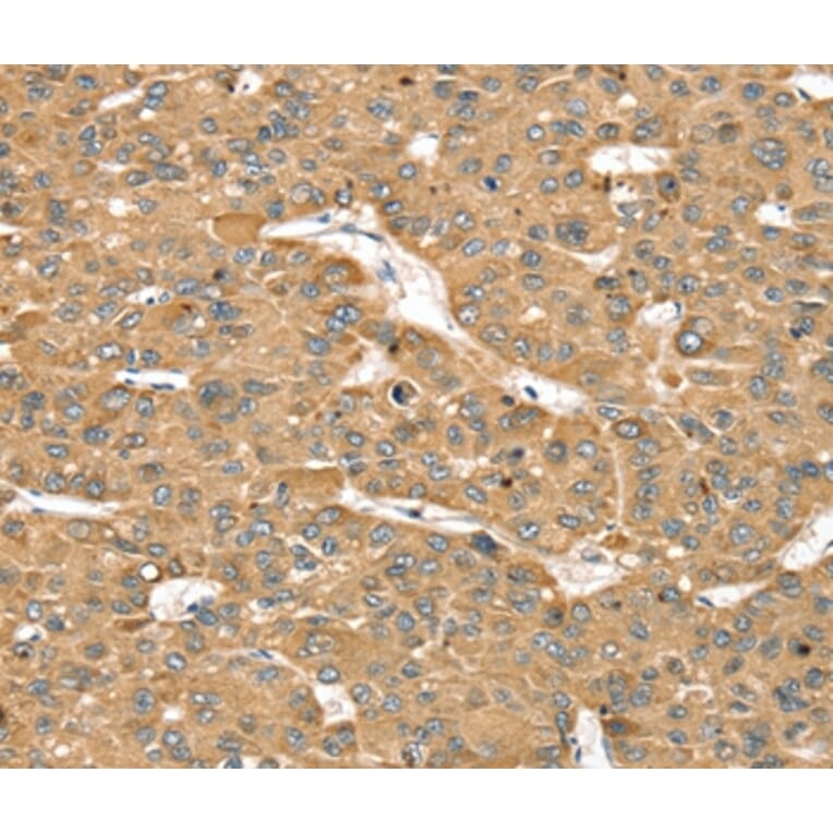 Immunohistochemistry - SMC4 Antibody from Signalway Antibody (37957) - Antibodies.com