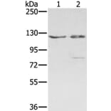 SMC6 Antibody from Signalway Antibody (37958) - Antibodies.com
