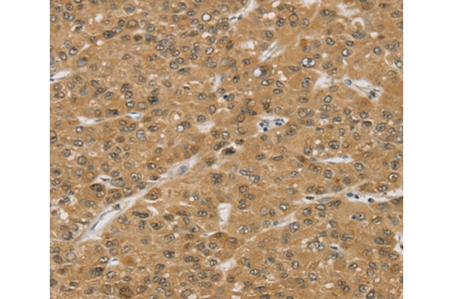 Immunohistochemistry - SMC6 Antibody from Signalway Antibody (37958) - Antibodies.com