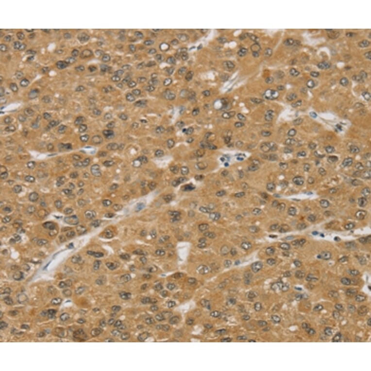 Immunohistochemistry - SMC6 Antibody from Signalway Antibody (37958) - Antibodies.com