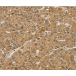Immunohistochemistry - SMC6 Antibody from Signalway Antibody (37958) - Antibodies.com