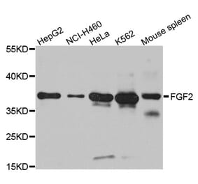 Western blot - FGF2 antibody from Signalway Antibody (38109) - Antibodies.com
