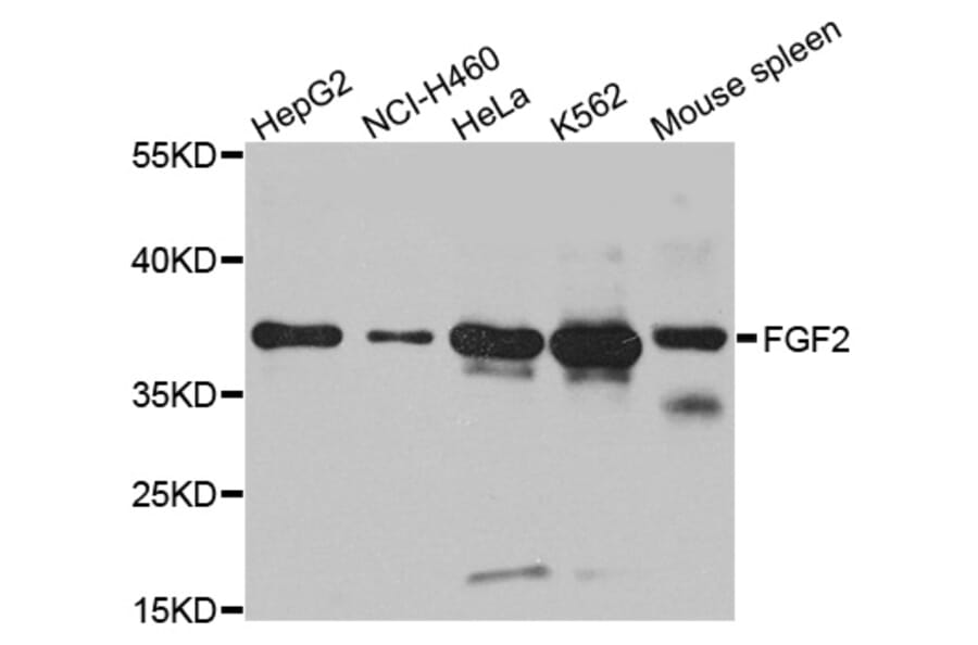 Western blot - FGF2 antibody from Signalway Antibody (38109) - Antibodies.com