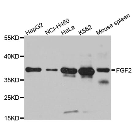 Western blot - FGF2 antibody from Signalway Antibody (38109) - Antibodies.com