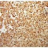 Immunohistochemistry - FGF2 antibody from Signalway Antibody (38109) - Antibodies.com