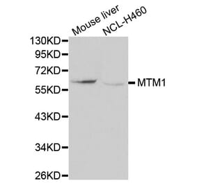 Western blot - MTM1 antibody from Signalway Antibody (38114) - Antibodies.com
