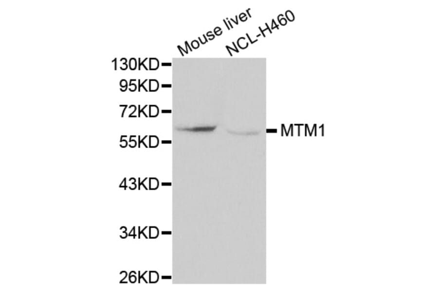 Western blot - MTM1 antibody from Signalway Antibody (38114) - Antibodies.com