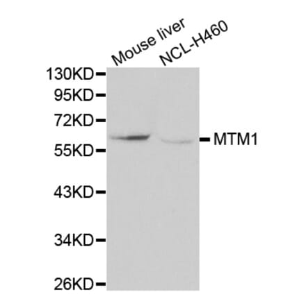 Western blot - MTM1 antibody from Signalway Antibody (38114) - Antibodies.com