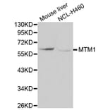 Western blot - MTM1 antibody from Signalway Antibody (38114) - Antibodies.com