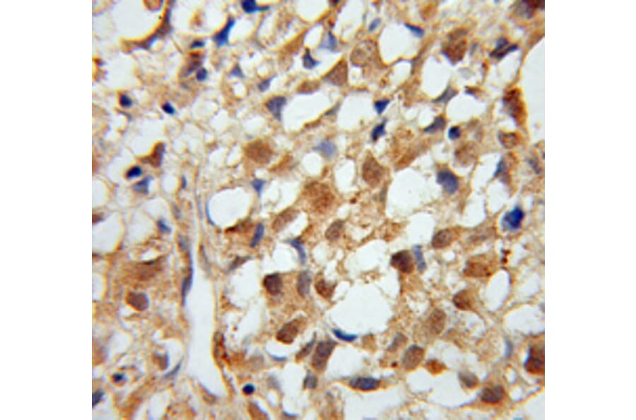 Immunohistochemistry - MTM1 antibody from Signalway Antibody (38114) - Antibodies.com