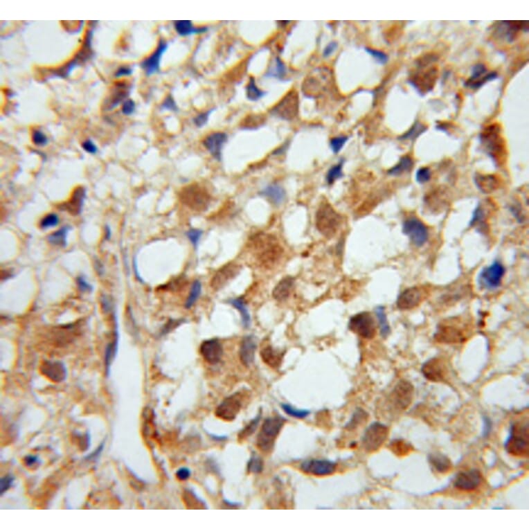 Immunohistochemistry - MTM1 antibody from Signalway Antibody (38114) - Antibodies.com