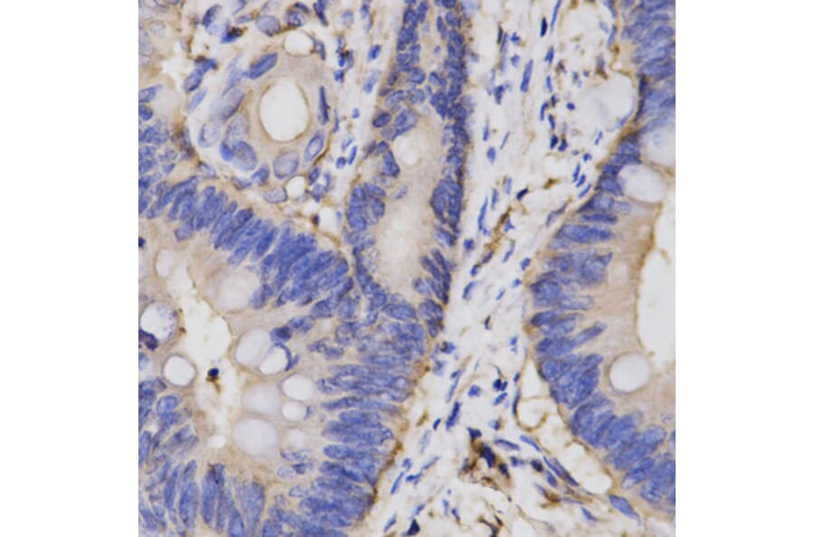 Immunohistochemistry - FAIM antibody from Signalway Antibody (38142) - Antibodies.com