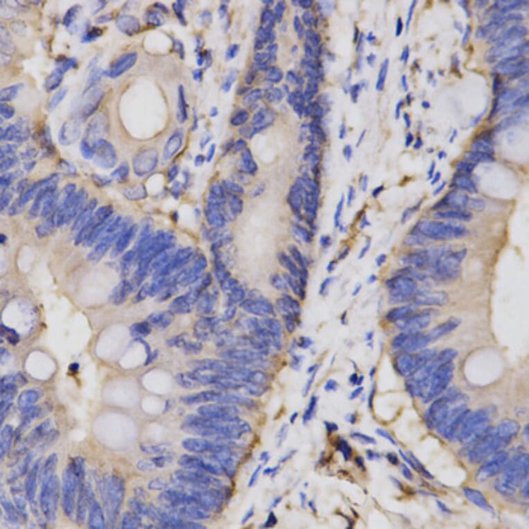 Immunohistochemistry - FAIM antibody from Signalway Antibody (38142) - Antibodies.com