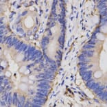 Immunohistochemistry - FAIM antibody from Signalway Antibody (38142) - Antibodies.com