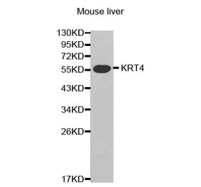 Western blot - KRT4 antibody from Signalway Antibody (38434) - Antibodies.com