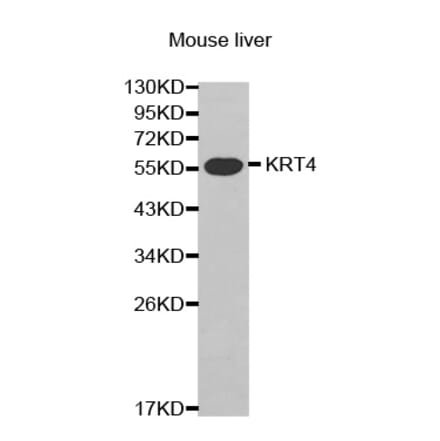 Western blot - KRT4 antibody from Signalway Antibody (38434) - Antibodies.com