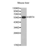 Western blot - KRT4 antibody from Signalway Antibody (38434) - Antibodies.com