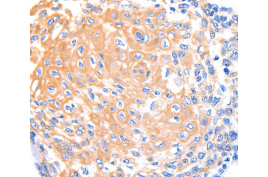 Immunohistochemistry - KRT4 antibody from Signalway Antibody (38434) - Antibodies.com