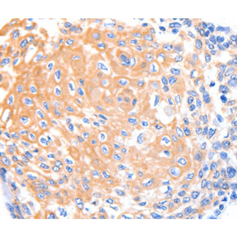 Immunohistochemistry - KRT4 antibody from Signalway Antibody (38434) - Antibodies.com