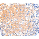 Immunohistochemistry - KRT4 antibody from Signalway Antibody (38434) - Antibodies.com