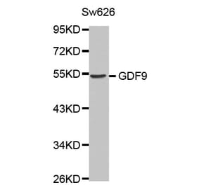 Western blot - GDF9 antibody from Signalway Antibody (38453) - Antibodies.com