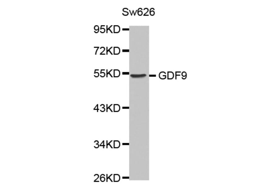 Western blot - GDF9 antibody from Signalway Antibody (38453) - Antibodies.com