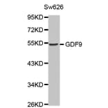 Western blot - GDF9 antibody from Signalway Antibody (38453) - Antibodies.com