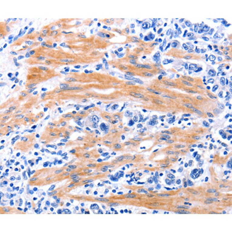 Immunohistochemistry - GDF9 antibody from Signalway Antibody (38453) - Antibodies.com