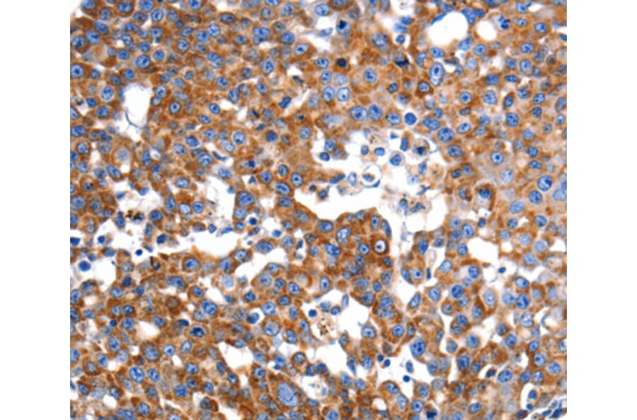 Immunohistochemistry - IMMT antibody from Signalway Antibody (38458) - Antibodies.com
