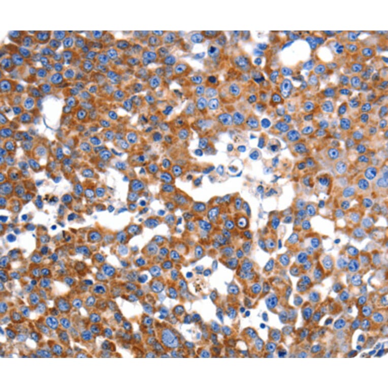 Immunohistochemistry - IMMT antibody from Signalway Antibody (38458) - Antibodies.com