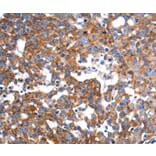 Immunohistochemistry - IMMT antibody from Signalway Antibody (38458) - Antibodies.com