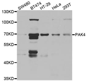 Western blot - PAK4 antibody from Signalway Antibody (38462) - Antibodies.com