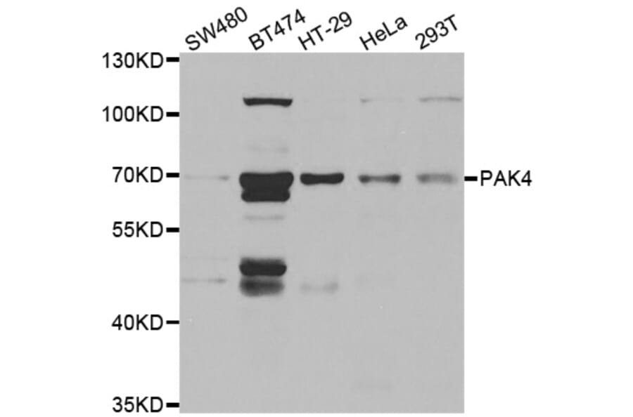 Western blot - PAK4 antibody from Signalway Antibody (38462) - Antibodies.com