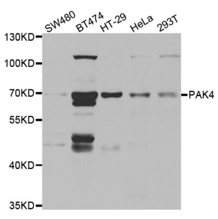 Western blot - PAK4 antibody from Signalway Antibody (38462) - Antibodies.com