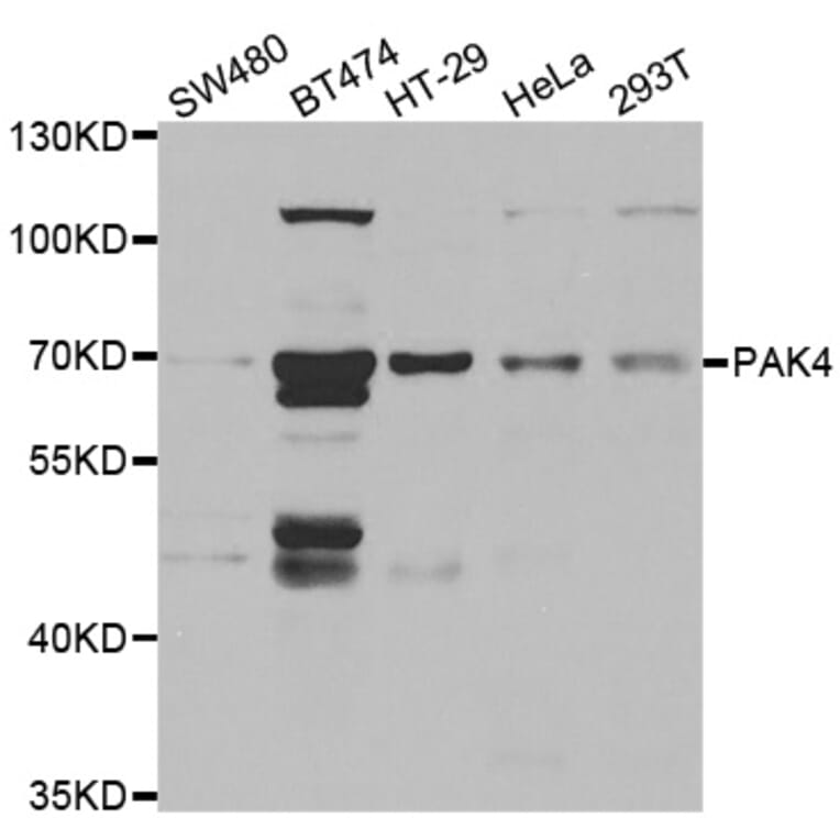 Western blot - PAK4 antibody from Signalway Antibody (38462) - Antibodies.com