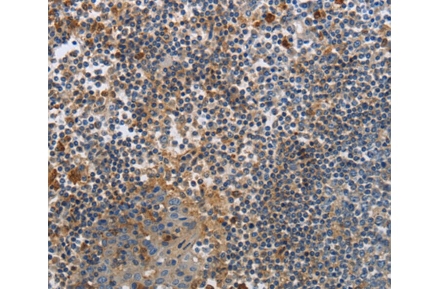Immunohistochemistry - PAK4 antibody from Signalway Antibody (38462) - Antibodies.com