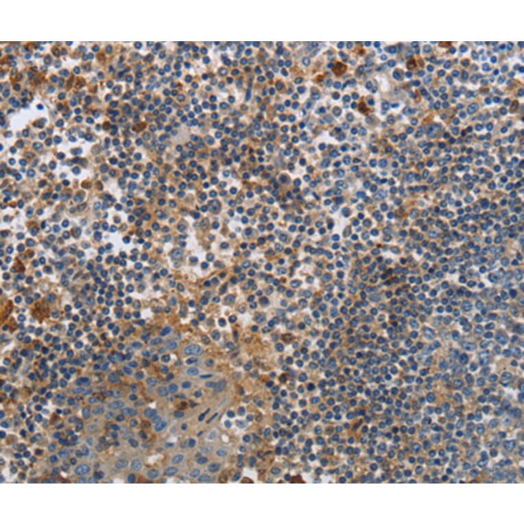 Immunohistochemistry - PAK4 antibody from Signalway Antibody (38462) - Antibodies.com