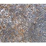 Immunohistochemistry - PAK4 antibody from Signalway Antibody (38462) - Antibodies.com