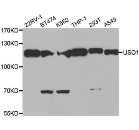 Western blot - USO1 antibody from Signalway Antibody (38470) - Antibodies.com