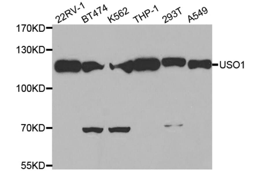 Western blot - USO1 antibody from Signalway Antibody (38470) - Antibodies.com