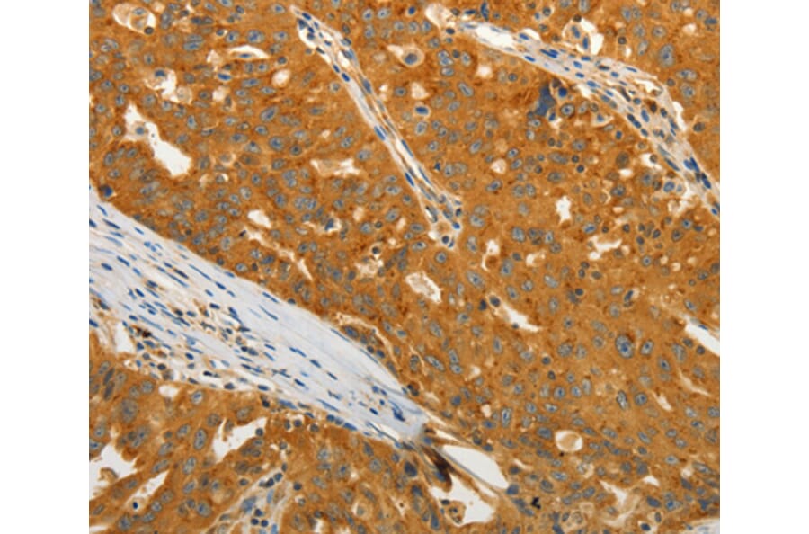 Immunohistochemistry - USO1 antibody from Signalway Antibody (38470) - Antibodies.com