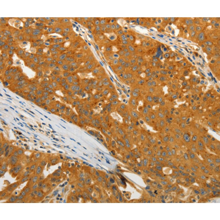 Immunohistochemistry - USO1 antibody from Signalway Antibody (38470) - Antibodies.com