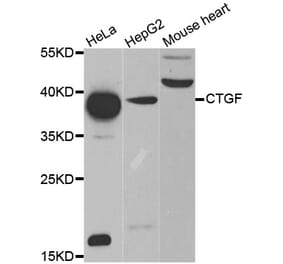 Western blot - CTGF antibody from Signalway Antibody (38476) - Antibodies.com