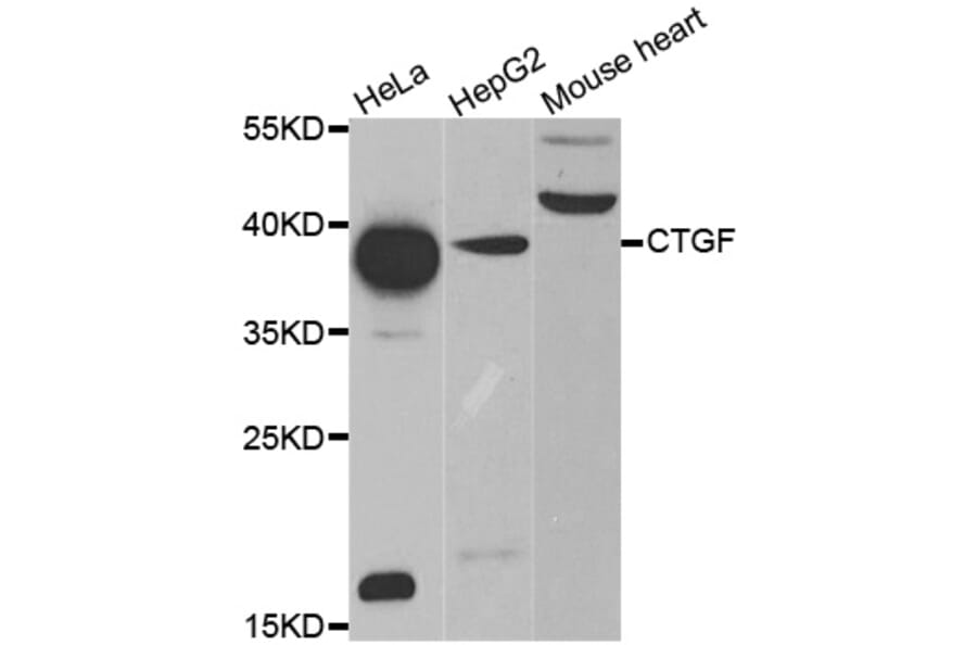 Western blot - CTGF antibody from Signalway Antibody (38476) - Antibodies.com
