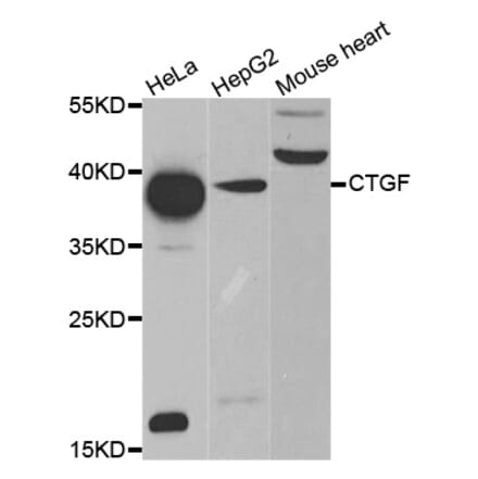 Western blot - CTGF antibody from Signalway Antibody (38476) - Antibodies.com