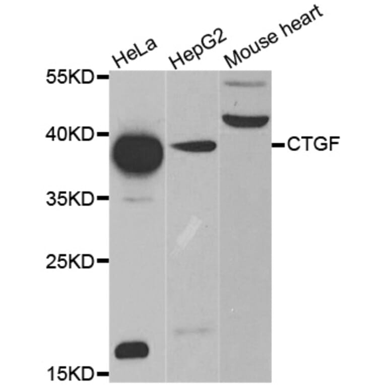 Western blot - CTGF antibody from Signalway Antibody (38476) - Antibodies.com