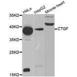 Western blot - CTGF antibody from Signalway Antibody (38476) - Antibodies.com