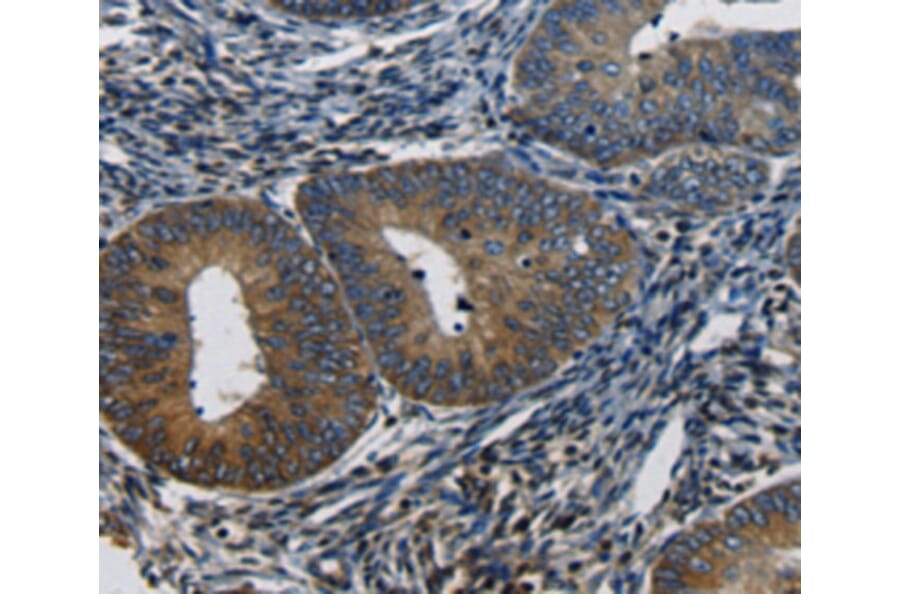 Immunohistochemistry - CTGF antibody from Signalway Antibody (38476) - Antibodies.com