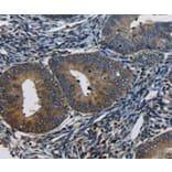 Immunohistochemistry - CTGF antibody from Signalway Antibody (38476) - Antibodies.com